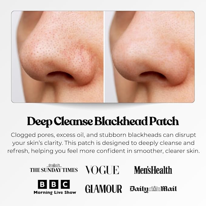 The Patch Collection® – Blackheads Deep Cleansing Pore Strips | Charcoal, Witch Hazel, Aloe Vera (Pack of 20)
