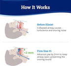 ZQuiet, Anti-Snoring Mouthpiece, Firm Size #1, Strong & Durable Mouthguard, Ideal for Those Prone to Teeth Grinding & Clenching, Made in USA, Size 1