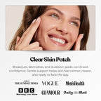 The Patch Collection® - Hydrocolloid Acne Spot Pimple Patch - Invisible Spot Remover Treatment Stickers for Face & Body, Vegan & Cruelty-Free (Pack of 72)