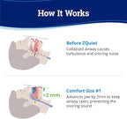 ZQuiet Anti-Snoring Mouthpiece Solution - Comfort Size #1 (Single Device) + Cleaner (1.5oz Bottle) - Made in USA Snoring Solution for a Better Night’s Sleep (Blue)