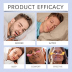 30 Pack Nasal Strips for Snoring, Anti-Snoring Nose Tape to Help Stop Snoring and Relieve Nasal Congestion. Sleep、Exercise Breathing, Extra Strength Anti-snoring Solution.