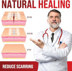 Emergency Wound Closure Strips - 2pk - Laceration Closure Kit - Stitchless & Easy to Use - Butterfly Bandages