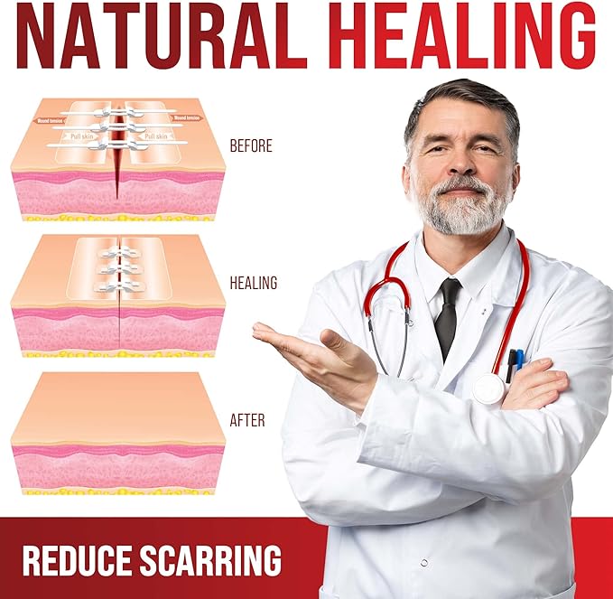 Emergency Wound Closure Strips - 4pk - 2 Types Sutures Free Laceration Closure Kit - Stitchless & Easy to Use - Butterfly Bandages for Cut Care - Perfect for Quick Stop Bleeding and Wound Closing