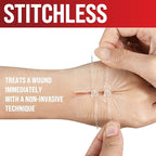 Emergency Wound Closure Strips - 2pk - Laceration Closure Kit - Stitchless & Easy to Use - Butterfly Bandages