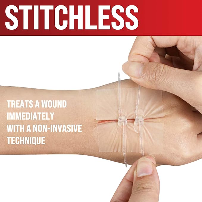 Emergency Wound Closure Strips - 2pk - Laceration Closure Kit - Stitchless & Easy to Use - Butterfly Bandages