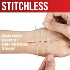 Emergency Wound Closure Strips - 2pk - Laceration Closure Kit - Stitchless & Easy to Use - Butterfly Bandages