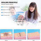 Emergency Wound Closure Device 2 Pcs Zip Stitch Sutures for Wounds Care Laceration Closure Kit Zipstitch Bandages Quick Clot Butterfly Bandaids