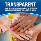 Cutter Bug Bite Patches Itch Relief Hydrocolloid Patches for Kids & Adults, Absorbs Fluids, Helps Heal, Prevents Scratching, Mosquito Itch Relief, Hydrocortisone & Suction Tool Alternative, 153 Count