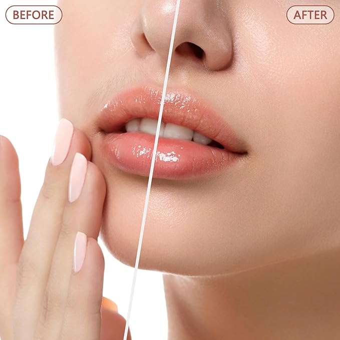 Facial Hair Remover for Women - as Seen on TV Painless Face Shaver - Electric Hair Removal Device for Face Lips Peach Fuzz with Light (Rose Gold)