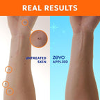 Zevo On-Body Tick & Mosquito Repellent Spray & Bug Repellent Lotion - 8 Hour Insect Protection - Odorless & Non-Sticky (1 Lotion, 1 Pump Bottle & 1 Aerosol Bottle)