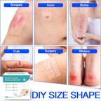 Hydrocolloid Bandages Roll 2" × 19.7' – Hydrocolloid Roll for Wound Care, Hydrocolloid Patch Large, Hydrocolloid Gel Bandages Hydrocolloid Dressing with Self-Adhesive, DIY Size Shape First Aid Kit