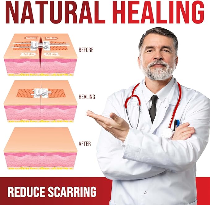 Emergency Wound Closure Strips - 2pk - Laceration Closure Kit - Stitchless & Easy to Use - Butterfly Bandages