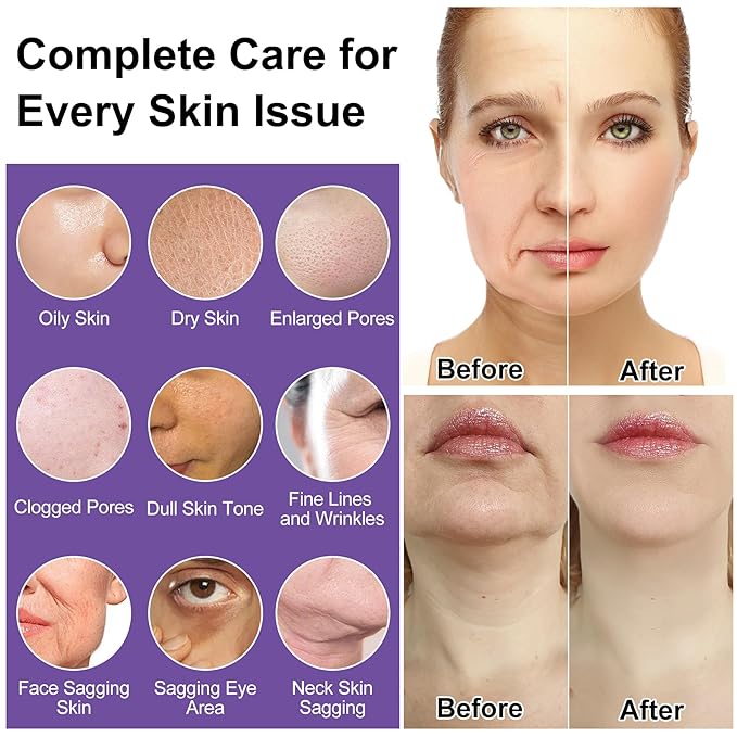 Skin Care Set,6Pcs Professional Womens Teens Tighten Lift Firm Skincare,Hydrate Anti-Aging Facial Routine Kit Travel Gift Set,Birthday Christmas Secret Santa Gifts for Women Teenage Girl Wife Mom | Professional