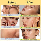 DOYEEWO Skin Care Set,6Pcs Women Teen Glass Skincare w/Korean Rice Extract,Hydrate Glow Repair Anti-Aging Facial Routine Kit Self Care Gifts for Women Mom Wife Teenage Girl Valentines Christmas Gifts