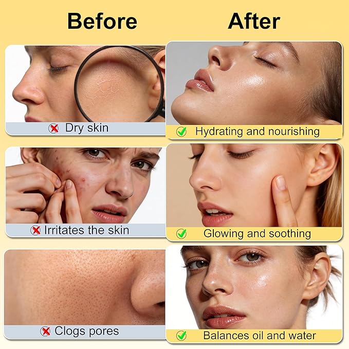 DOYEEWO Skin Care Set,6Pcs Women Teen Glass Skincare w/Korean Rice Extract,Hydrate Glow Repair Anti-Aging Facial Routine Kit Self Care Gifts for Women Mom Wife Teenage Girl Valentines Christmas Gifts