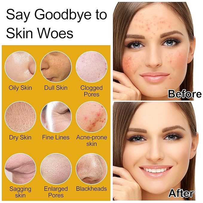 Skin Care Set,4Pcs Women Teen Glass Skincare w/Korean Rice Extract,Hydrate Glow Repair Anti-Aging Facial Routine Mini Kit Self Care Gifts for Women Mom Wife Teens Teenage Girl Airplane-Friendly Sizes